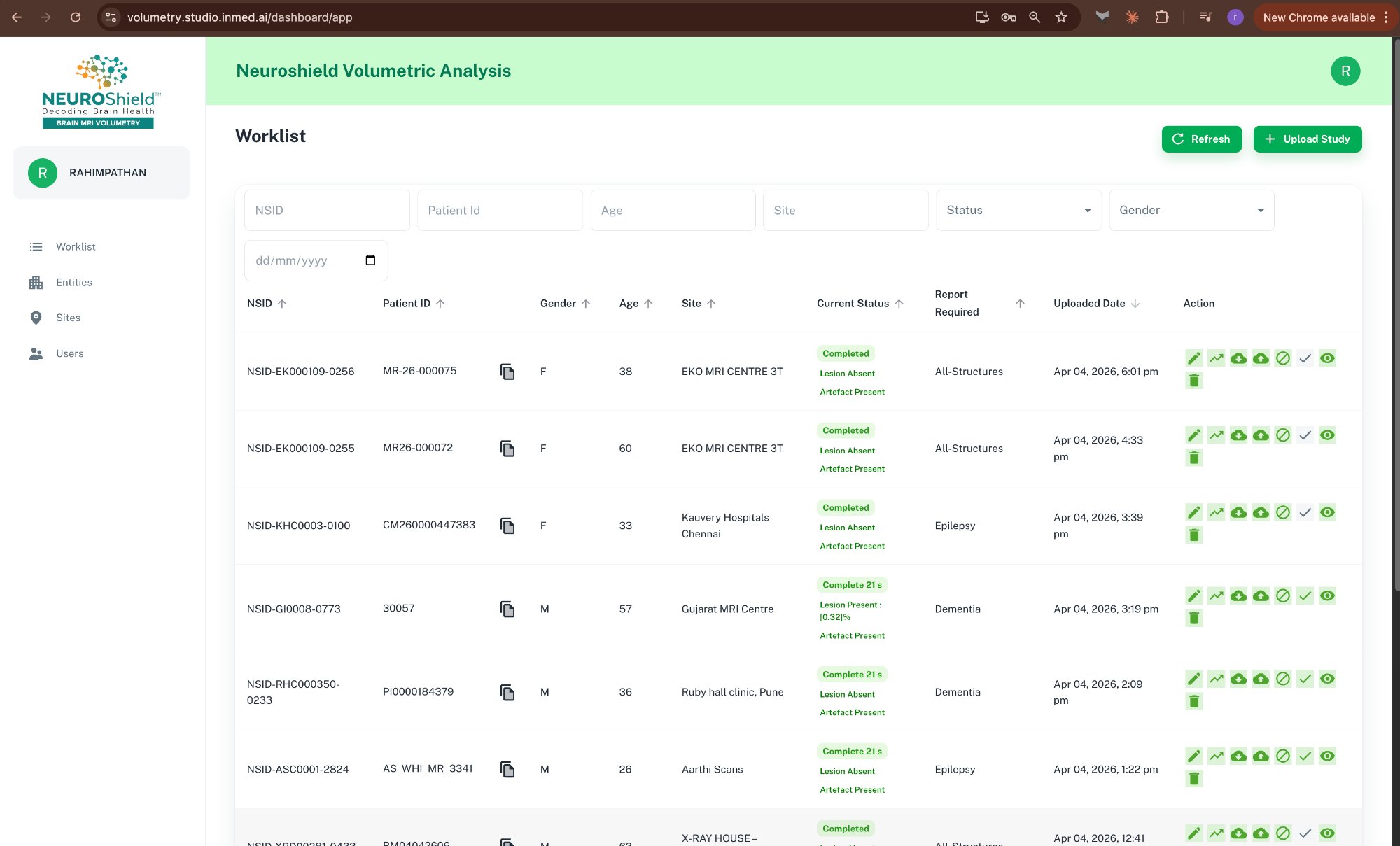 NeuroShield Volumetric Analysis Dashboard — Worklist with patient studies, scan statuses, and site management